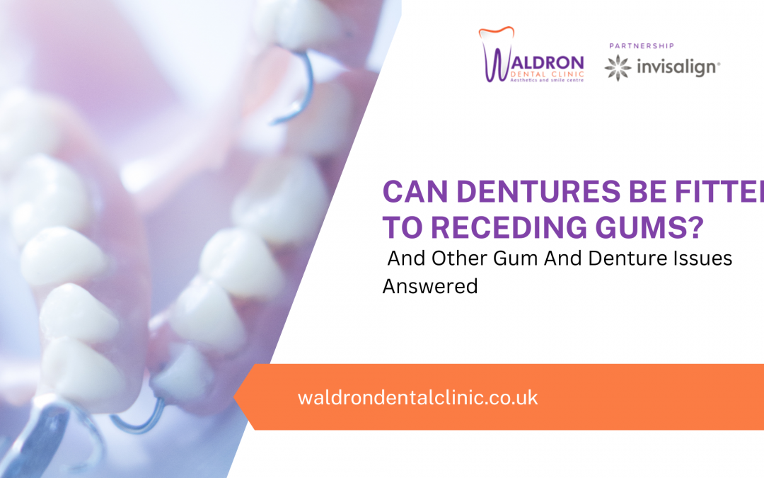 Can Dentures Be Fitted To Receding Gums? And Other Gum And Denture Issues Answered