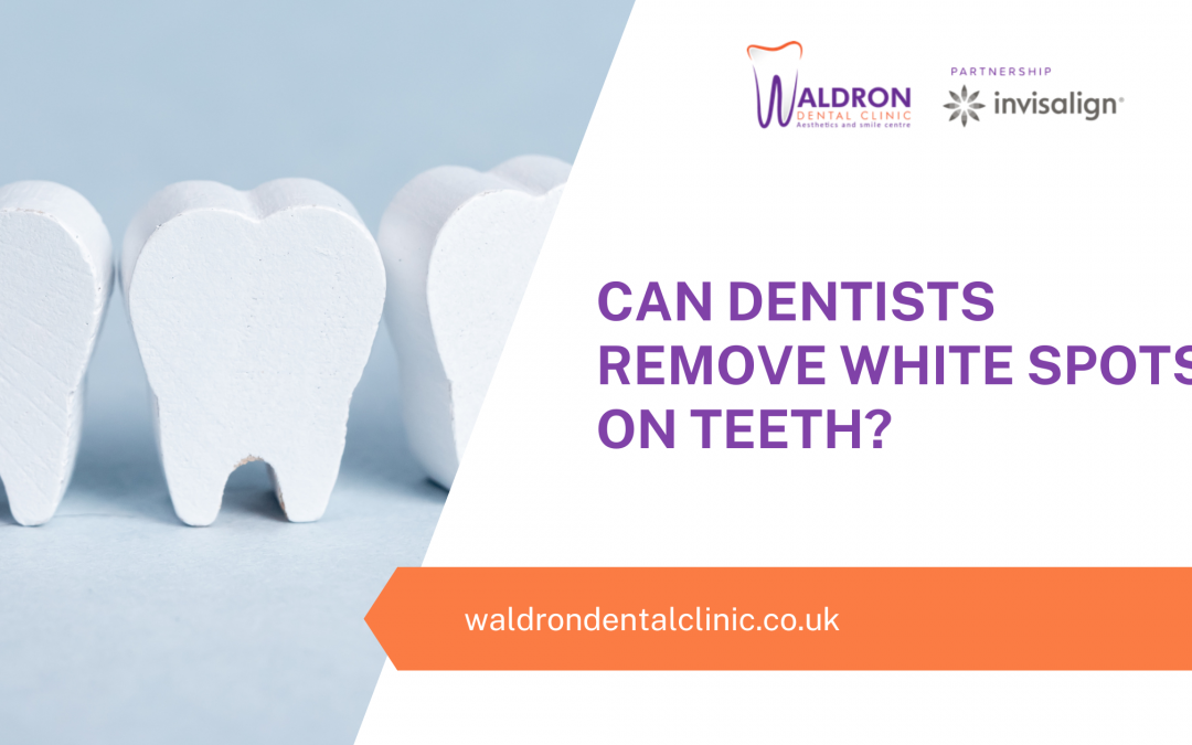 Can Dentists Remove White Spots On Teeth?