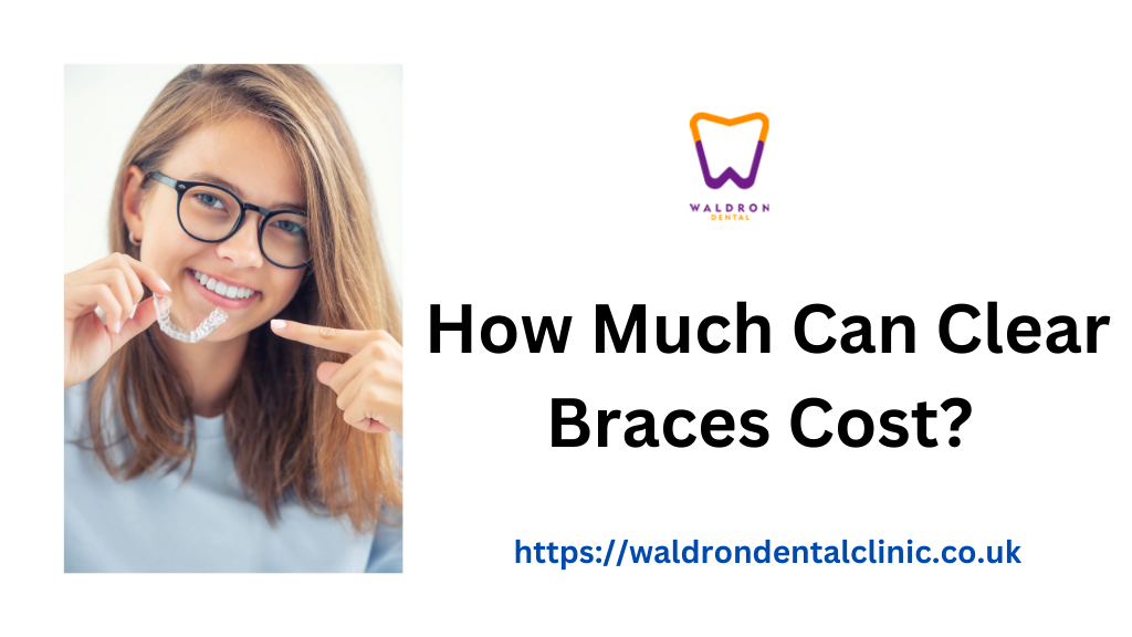 How Much Can Clear Braces Cost?