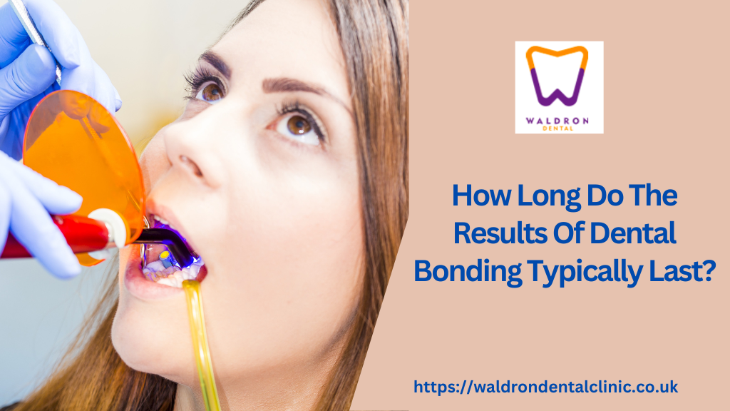 How Long Do The Results Of Dental Bonding Typically Last?