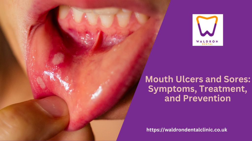 Mouth Ulcers And Sores: Symptoms, Treatment, And Prevention